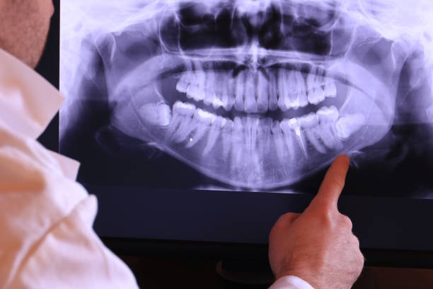 Best Emergency Denture Repair in Lakehills, TX